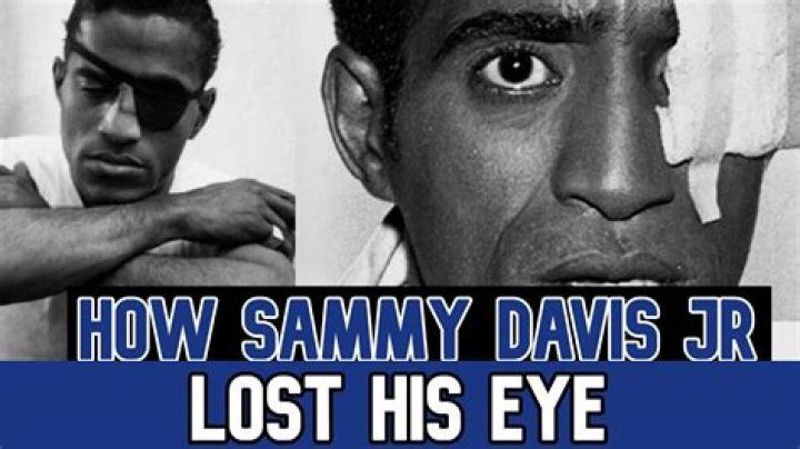 Did Sammy Davis Jr have a glass eye? – Celebrity.fm – #1 Official Stars, Business & People Network, Wiki, Success story, Biography & Quotes