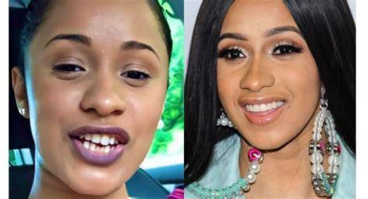 Does Cardi B have real teeth? – Celebrity.fm – #1 Official Stars, Business & People Network, Wiki, Success story, Biography & Quotes